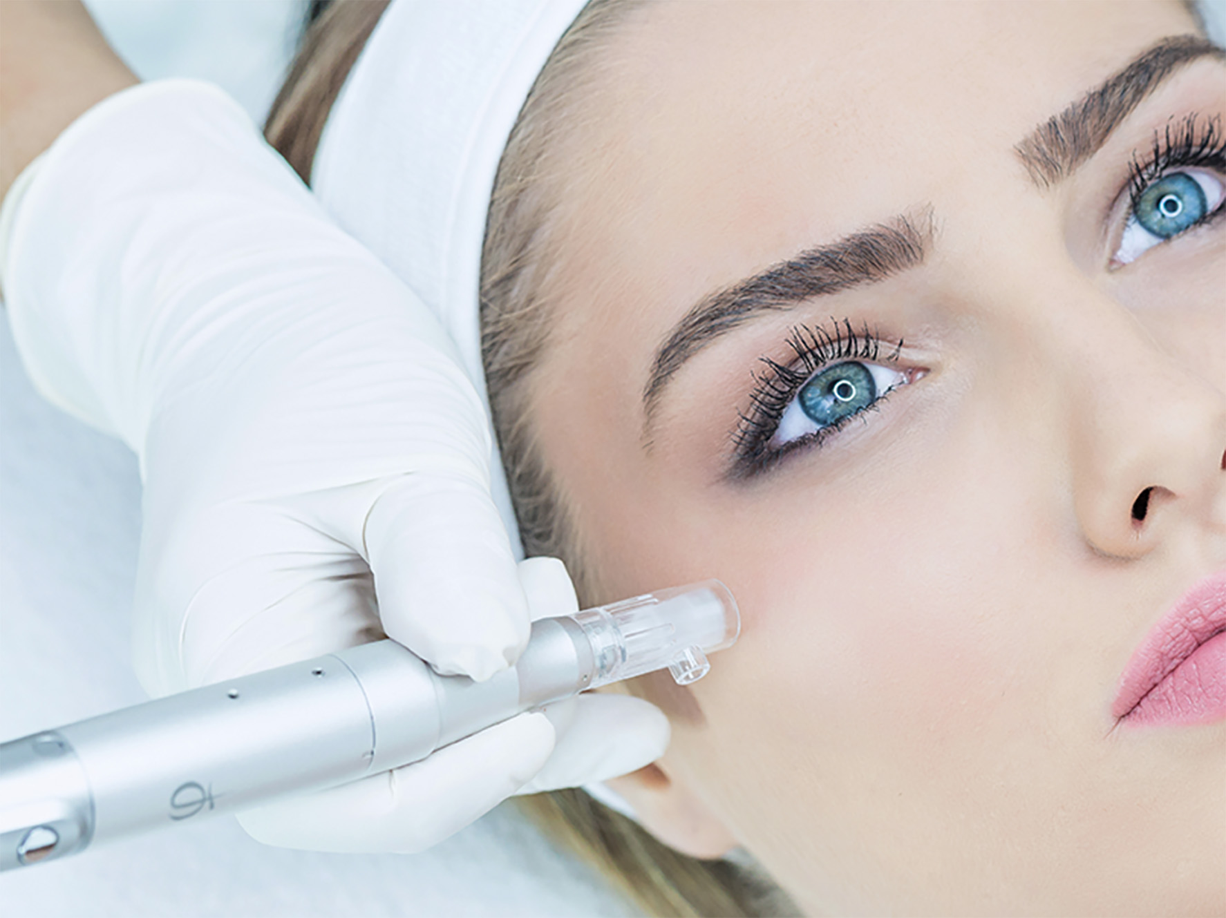 Traitement de MICRONEEDLING