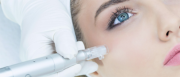Traitement de MICRONEEDLING