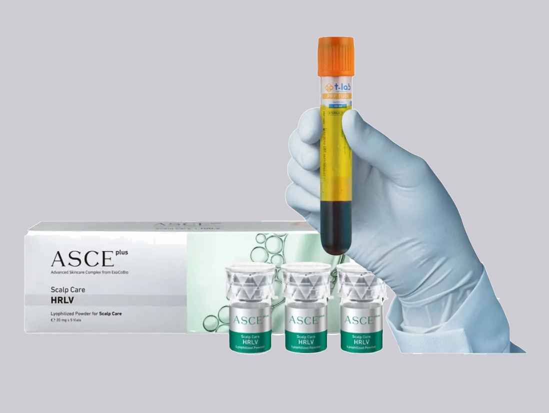 Traitement PRP & EXOSOMES (Peau ou cheveux)